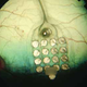 Image for article titled New implant allows the blind to stream Braille directly onto their retinas